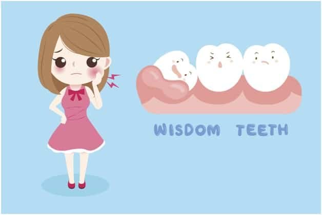 Wisdom Teeth Removal